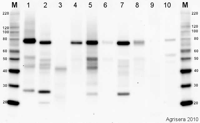 western blot using plant anti-BiP antibodies